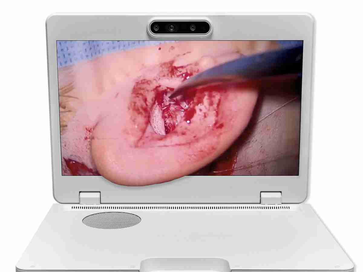 达擎之＂Heads-up 3D显微手术显示系统＂，，，整合4K裸眼3D显示及眼球追踪系统，，具备快速追踪人眼移动位置功能，，，，减轻医师长时间维持固定姿势的负担，，让医师能有更宽广清晰的3D立体视野及更舒适的姿势来执行手术。。。